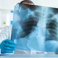What to Expect at a Colorado Workers’ Compensation IME: Guidance for Injured Workers in Arvada and Denver What to Expect at a Colorado Workers’ Compensation IME: Guidance for Injured Workers in Arvada and Denver